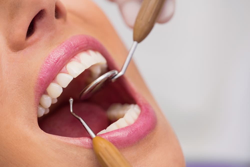 ¿Cómo prevenir las manchas en los dientes?