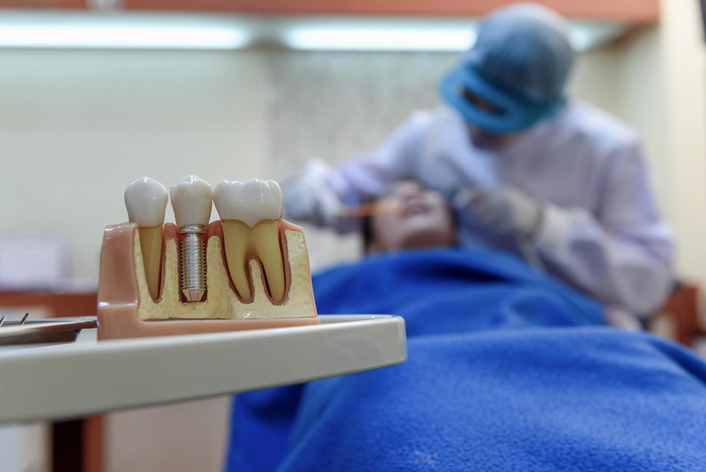 Síntomas de rechazo a un implante dental